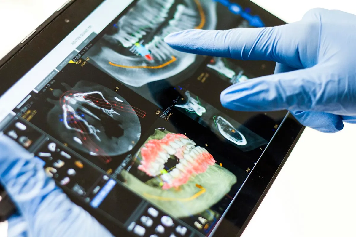 Clinician in a blue glove pointing at a three-dimensional dental CT scan on a tablet