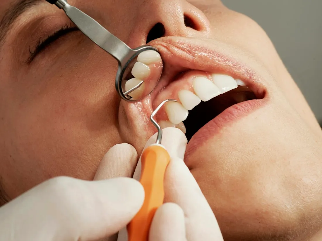 Close-up of a dental examination using a mouth mirror and probe